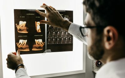 Tooth Extractions: What You Need to Know