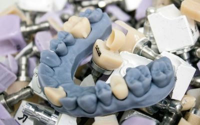 Answers to Your Dental Crown Questions