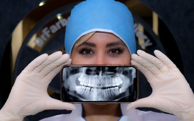 What to Expect After Wisdom Teeth Removal: Recovery Timeline and Expert Tips